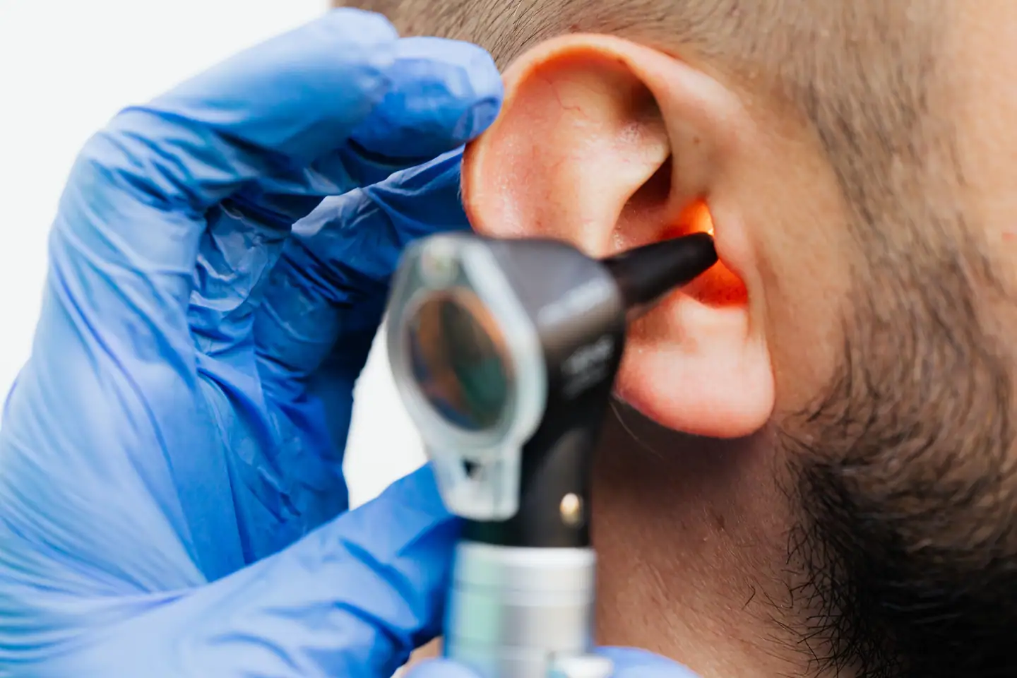 Blick ins Ohr mit dem Otoskop, Hände in blauen Handschuhen